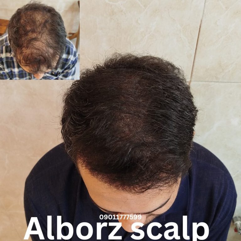 نمونه کار البرز اسکالپ-0 نمونه کار البرز اسکالپ-0