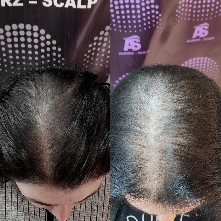 نمونه کار البرز اسکالپ-3 نمونه کار البرز اسکالپ-3