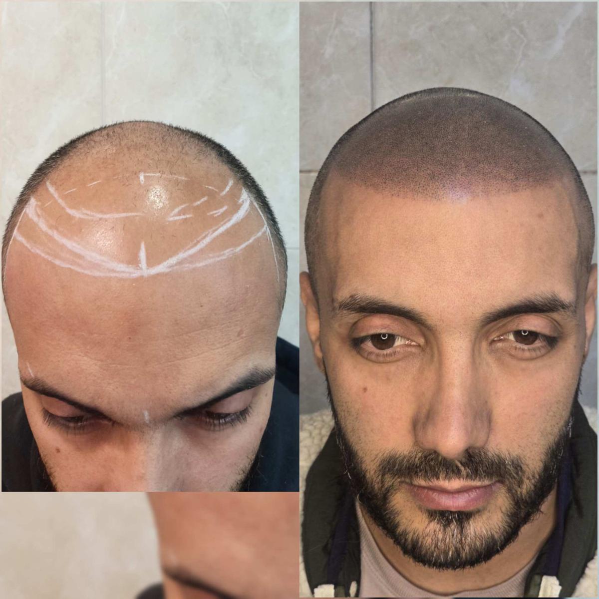 اسکالپ اسپرت