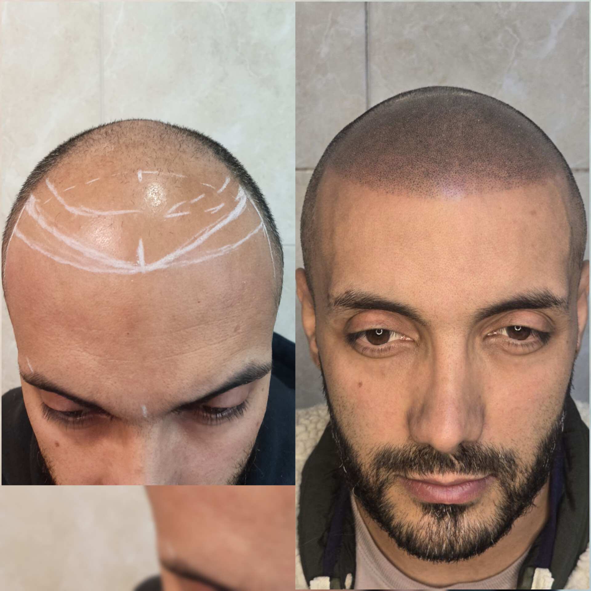 اسکالپ اسپرت