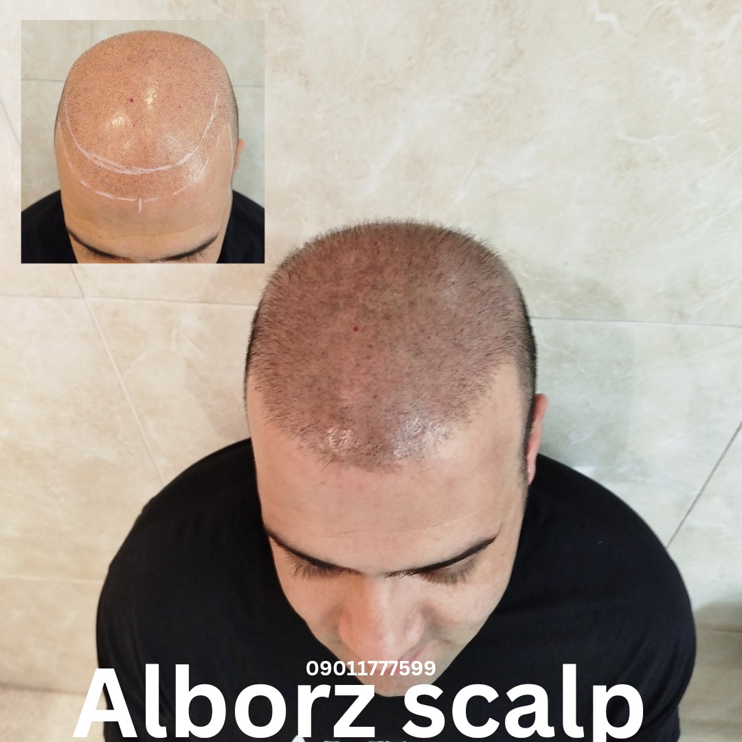 اسکالپ اسپرت