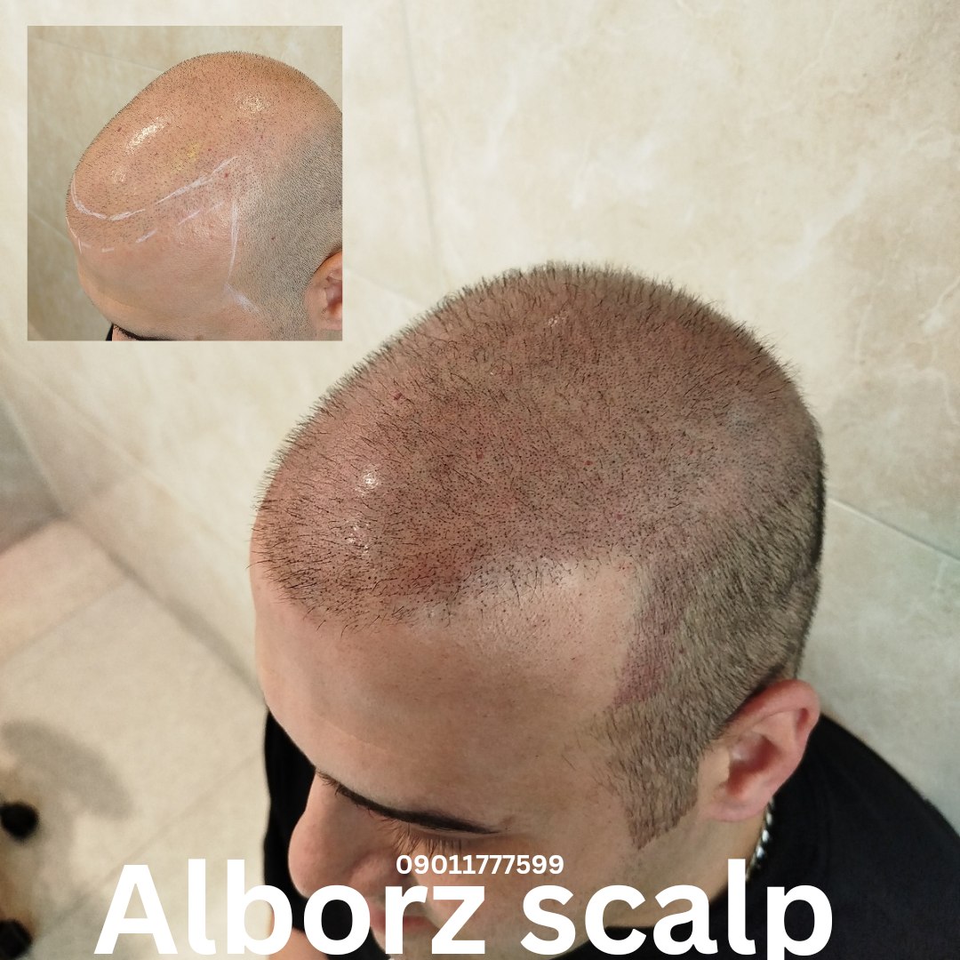 اسکالپ اسپرت