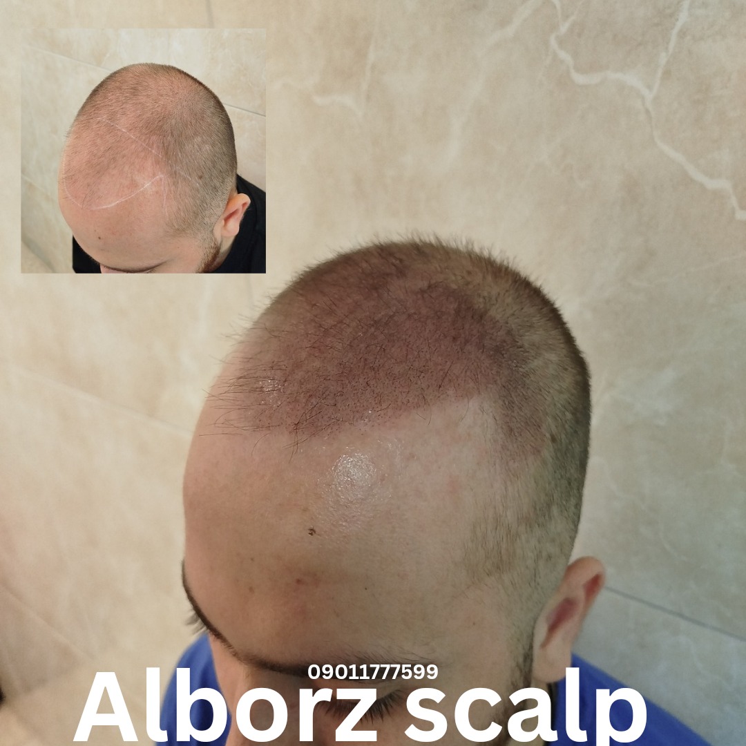 اسکالپ اسپرت