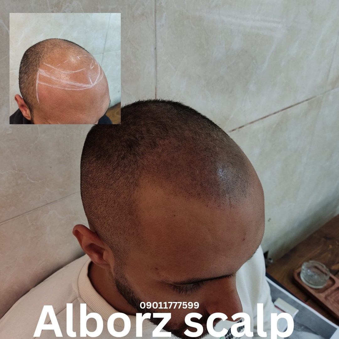 اسکالپ اسپرت