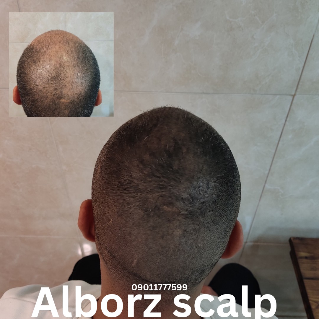 اسکالپ اسپرت