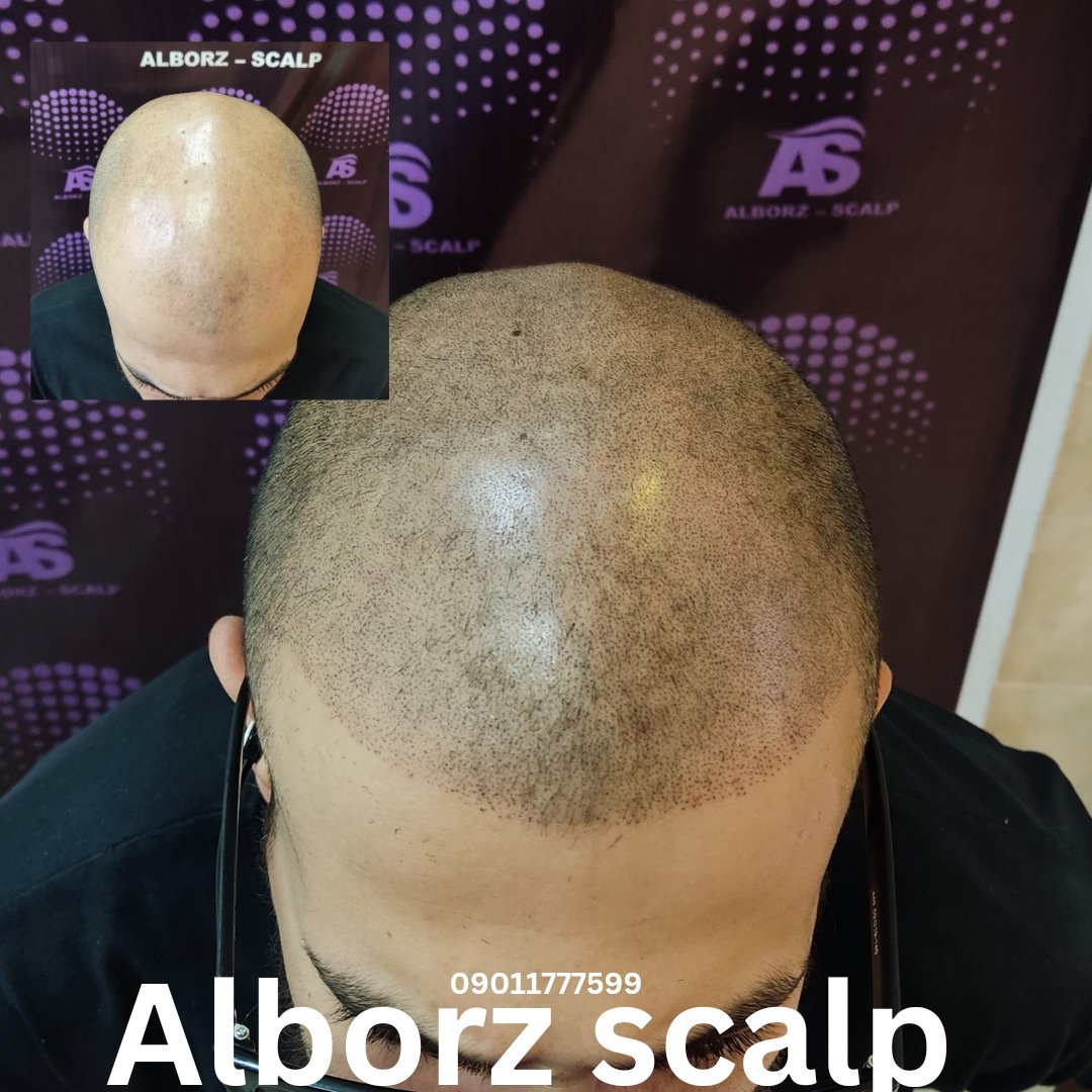 اسکالپ اسپرت