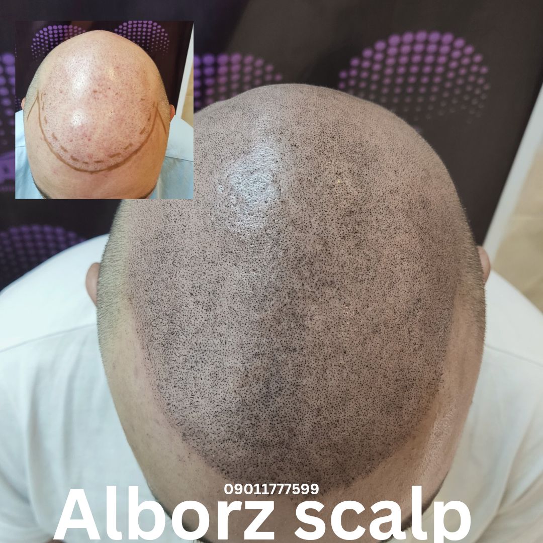 اسکالپ اسپرت