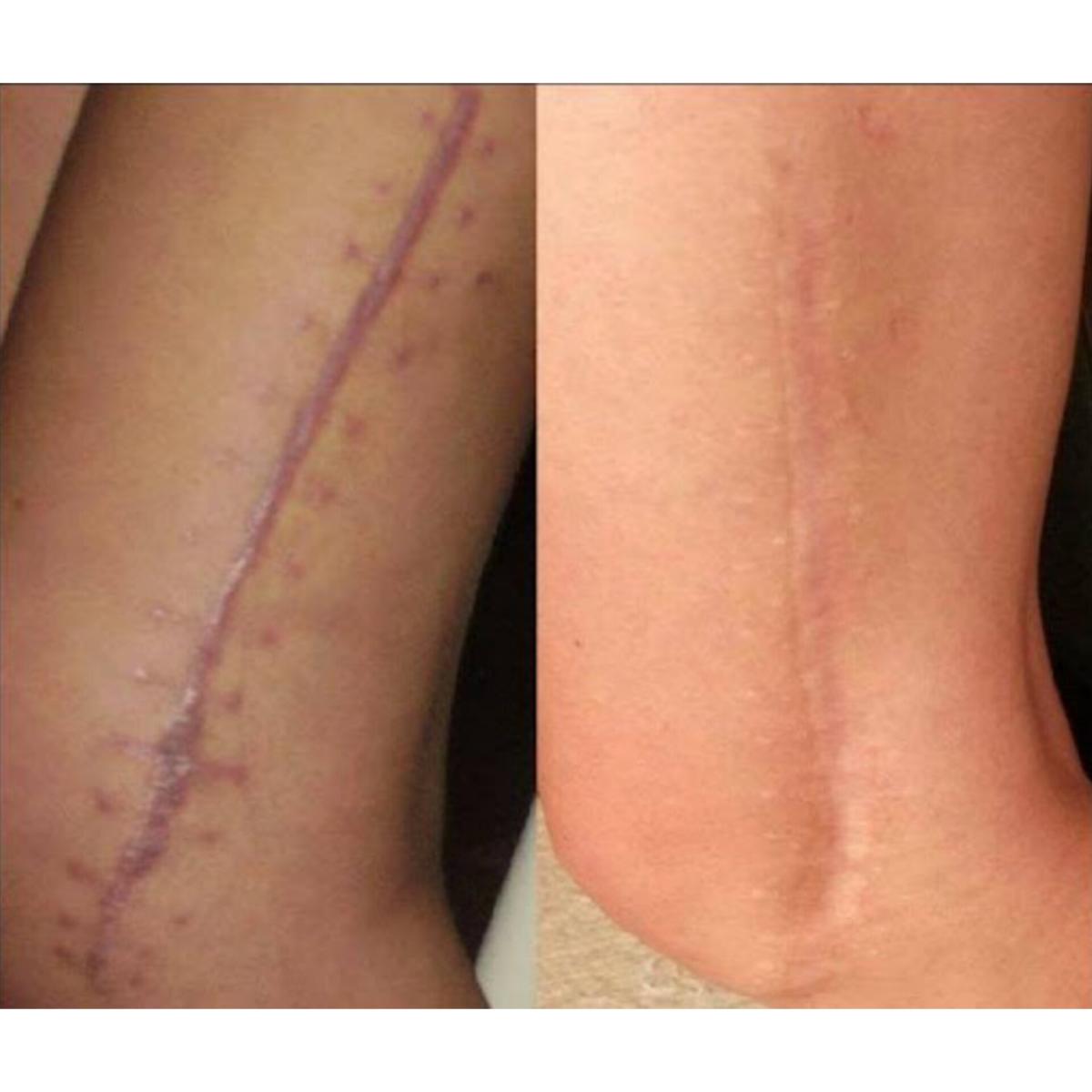 کاموفلاژ(همسان سازی رنگ پوست)