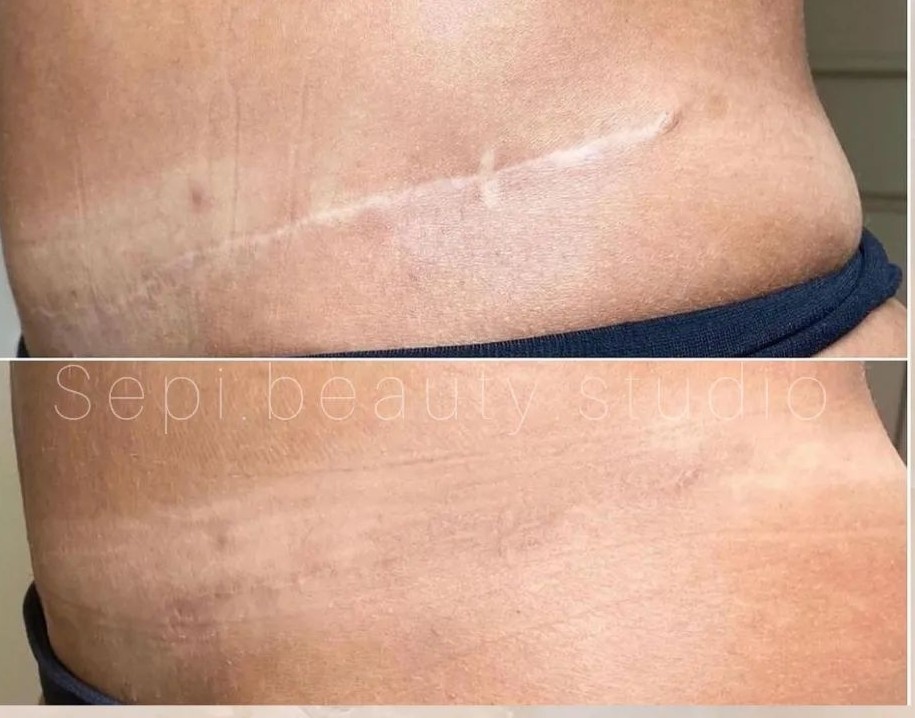 کاموفلاژ(همسان سازی رنگ پوست)