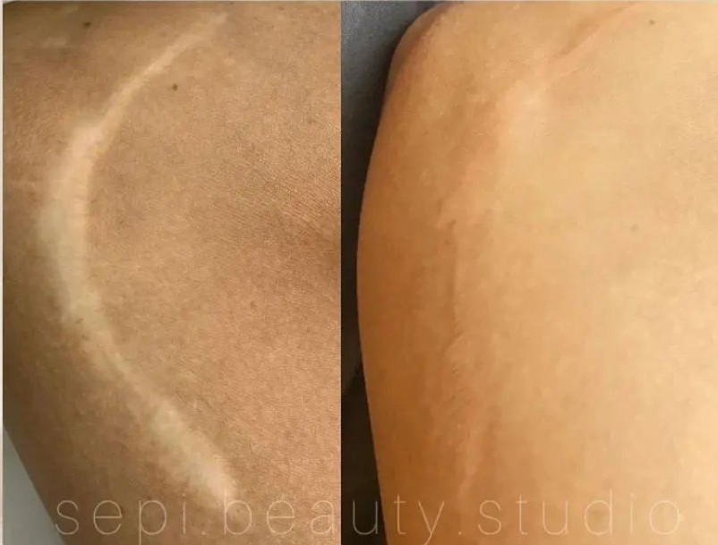 کاموفلاژ(همسان سازی رنگ پوست)