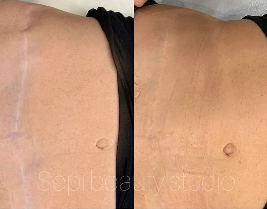 کاموفلاژ(همسان سازی رنگ پوست)