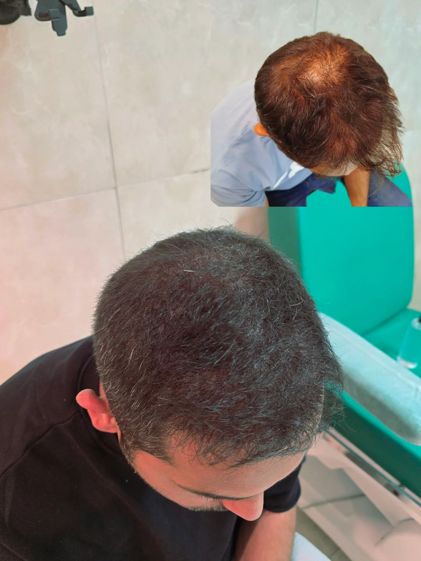 نمونه میکرواسکالپ